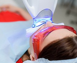 In-office teeth whitening treatment